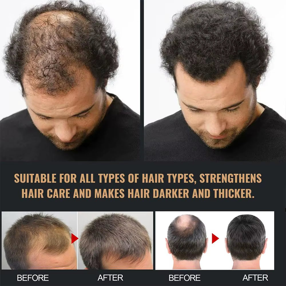Revitalize Your Hair with Our 2-Piece Anti-Baldness Thickening Root Activator Shampoo - Nourish and Regrow Thinning Hair
