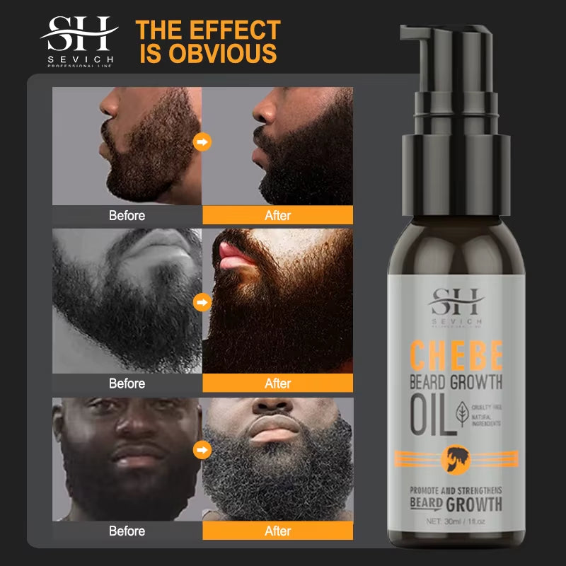 Natural Chebe Beard Growth Oil - Fast-Acting Essential Serum for Effective Beard Growth and Hair Loss Treatment