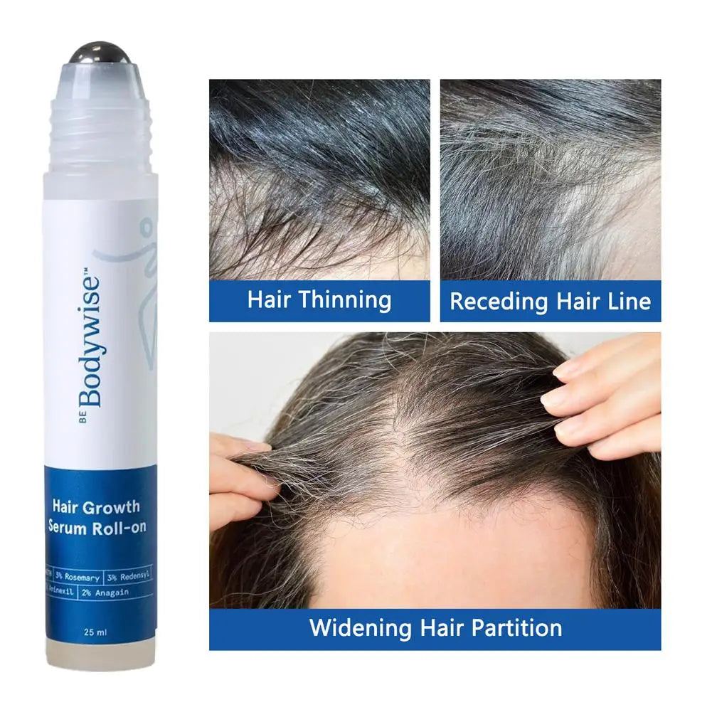 25ML Natural Rosemary Hair Care Essence Ball Deeply Repair Damaged Hair Moisturizing Repairing Strengthening Hair Care