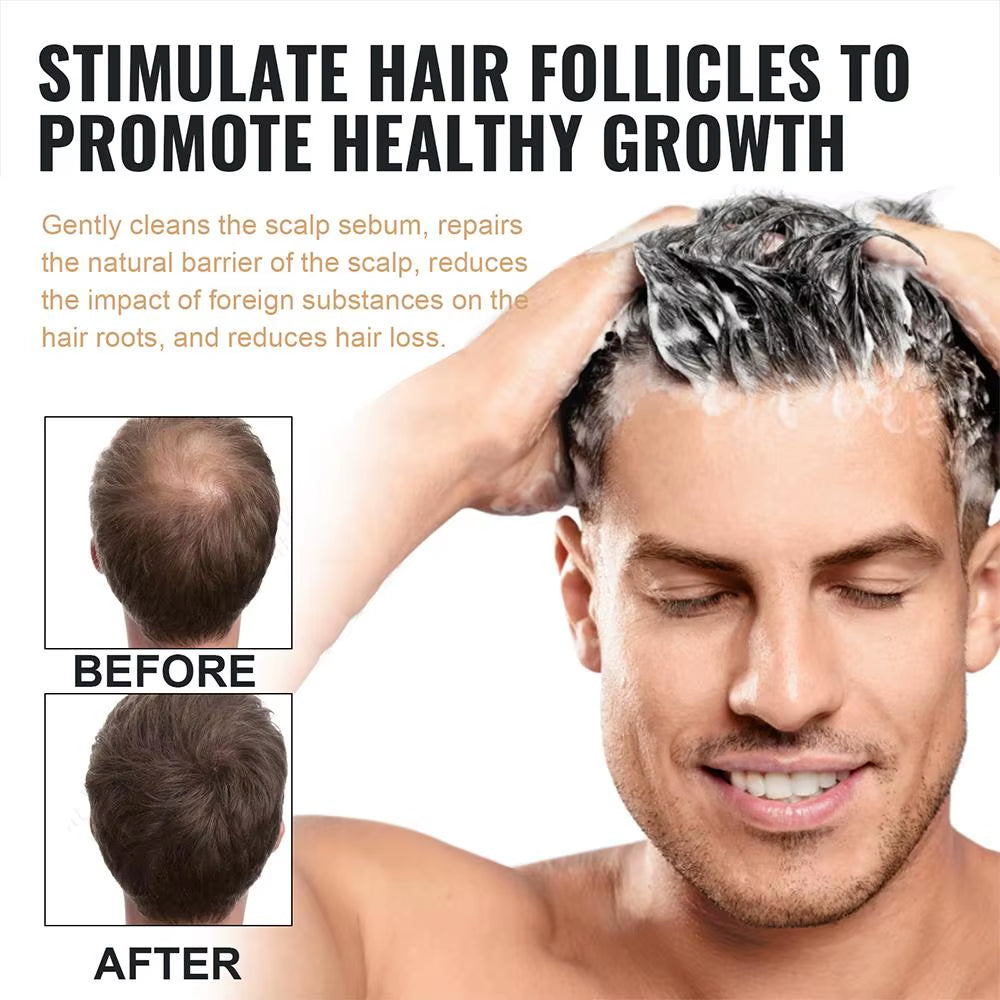Revitalize Your Hair with Our 2-Piece Anti-Baldness Thickening Root Activator Shampoo - Nourish and Regrow Thinning Hair