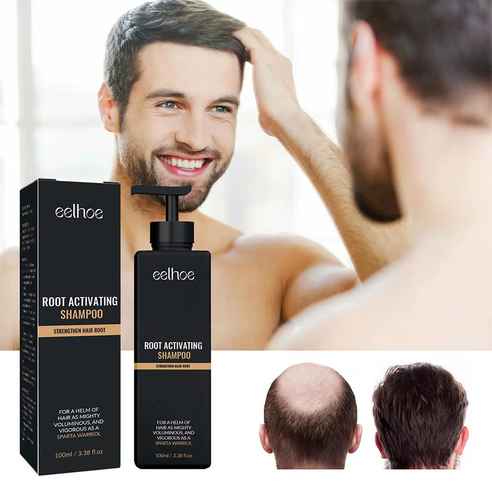 Revitalize Your Hair with Our 2-Piece Anti-Baldness Thickening Root Activator Shampoo - Nourish and Regrow Thinning Hair