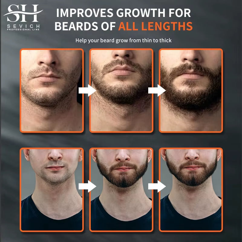 Natural Chebe Beard Growth Oil - Fast-Acting Essential Serum for Effective Beard Growth and Hair Loss Treatment