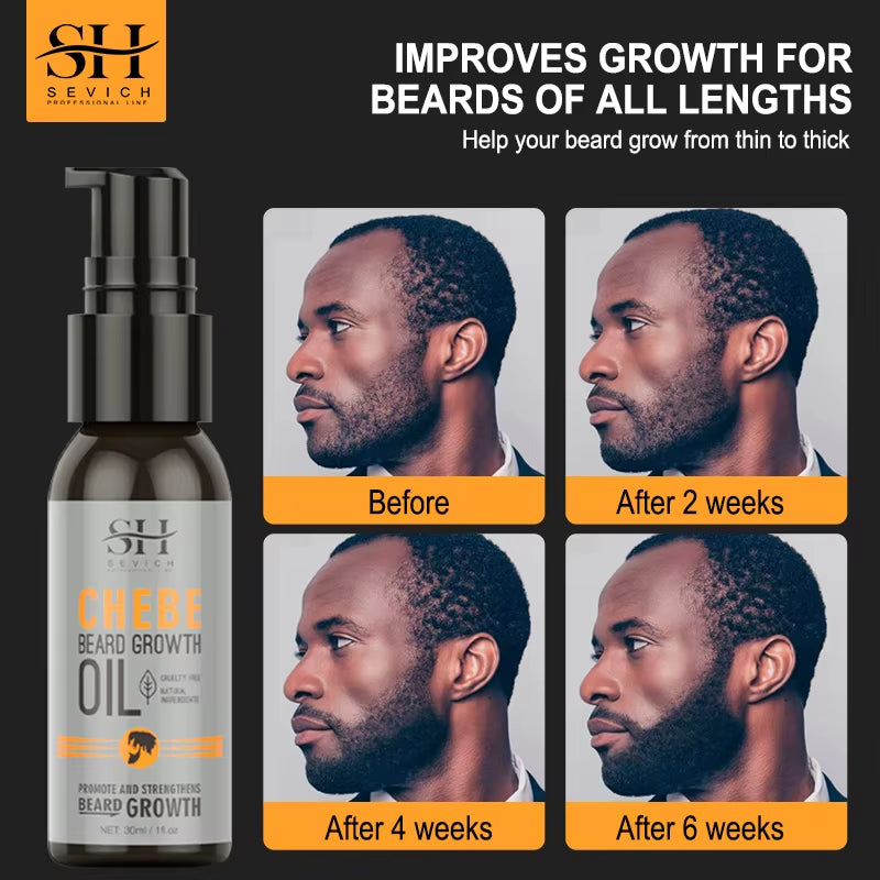 Natural Chebe Beard Growth Oil - Fast-Acting Essential Serum for Effective Beard Growth and Hair Loss Treatment