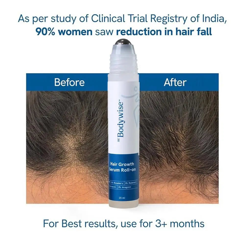 25ML Natural Rosemary Hair Care Essence Ball Deeply Repair Damaged Hair Moisturizing Repairing Strengthening Hair Care