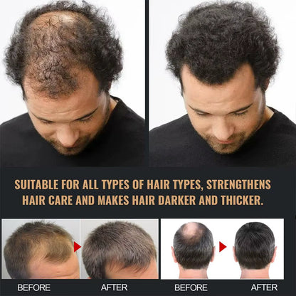 Revitalize Your Hair with Our 2-Piece Anti-Baldness Thickening Root Activator Shampoo - Nourish and Regrow Thinning Hair