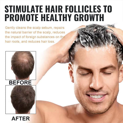 Revitalize Your Hair with Our 2-Piece Anti-Baldness Thickening Root Activator Shampoo - Nourish and Regrow Thinning Hair