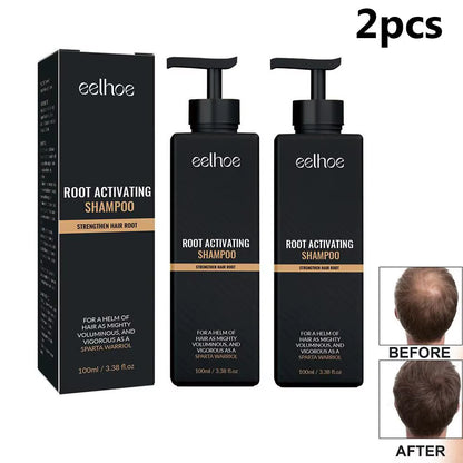 Revitalize Your Hair with Our 2-Piece Anti-Baldness Thickening Root Activator Shampoo - Nourish and Regrow Thinning Hair